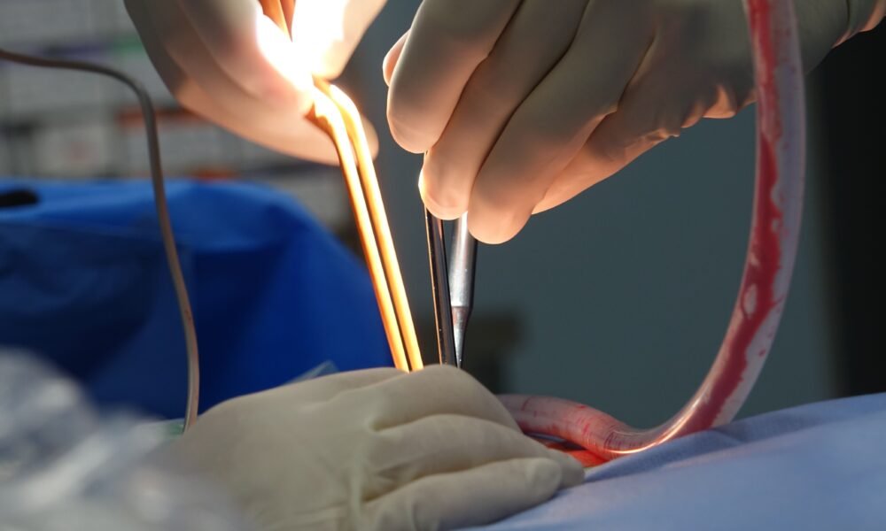 Appendicitis