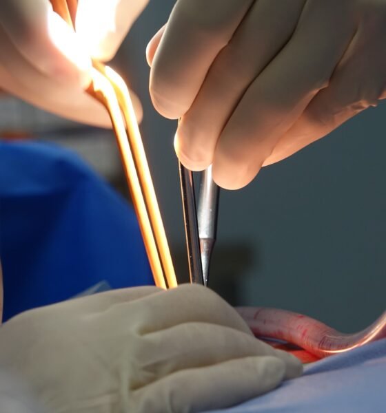 Appendicitis