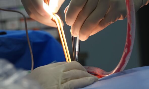 Appendicitis