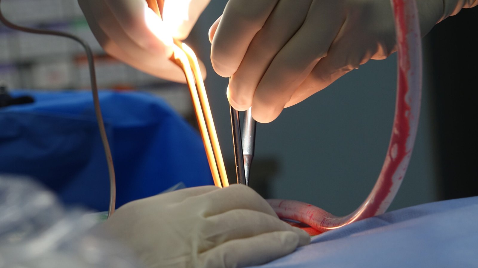 Appendicitis